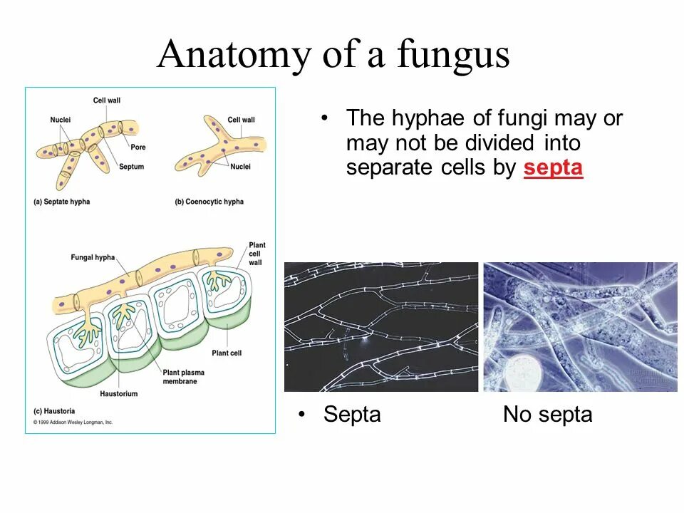Fungi днк. Streptomyces avermitilis под микроскопом. Ризопус микроскопия. Кокцидиоидоз возбудитель. Fungi днк в мазке что это такое.