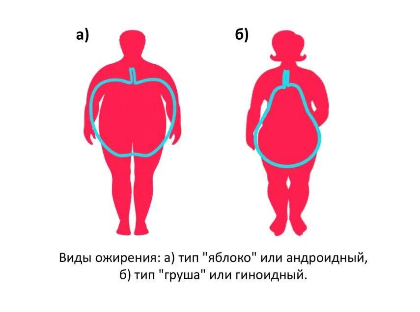 Типы ожирения гиноидное и андроидное. Ожирение. Типы ожирения у женщин. Смешанный Тип ожирения.