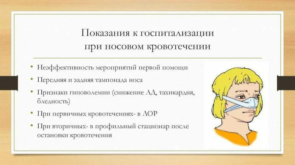 Помощь при носовом кровотечении. Оказание 1 помощи при носовом кровотечении. Носовое кровотечение показания к госпитализации. Показания к госпитализации при носовом кровотечении.