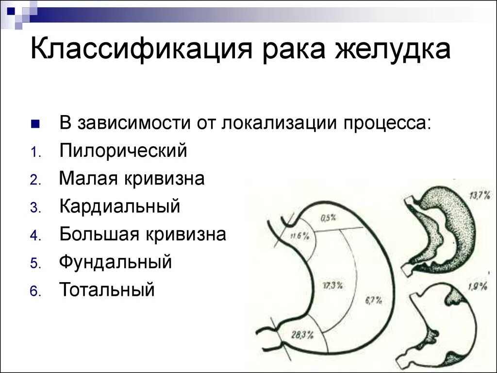 Локализация опухоли желудка. Онкология желудка классификация. Полное удаление желудка