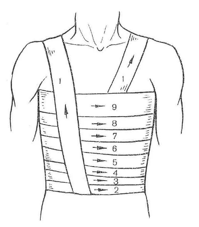 Повязка на грудную клетку алгоритм. Техника наложения спиральной повязки на грудную клетку. Спиралевидная повязка на грудную клетку показания. Техника наложения спиралевидной повязки. Спиралевидная повязка на грудную клетку алгоритм.