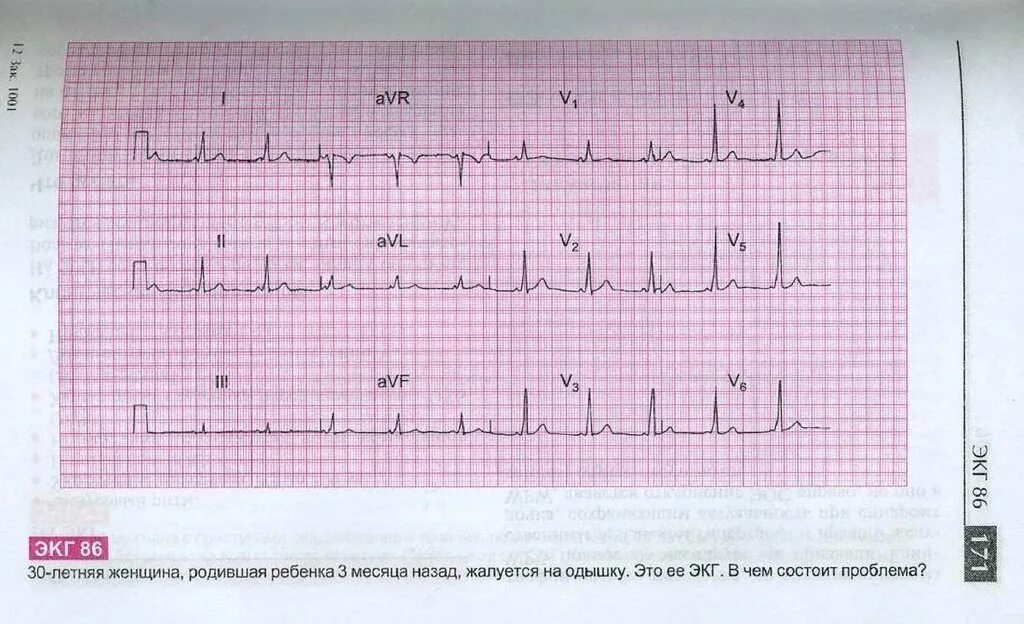 кардиограмма форум. экг расшифровка. хорошая кардиограмма. кардиограмма форум. кардиограмма форум.