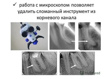Выводить сломать