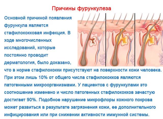 Почему после полового контакта