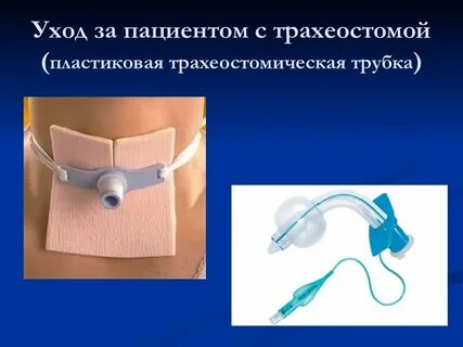 Трубка пациента