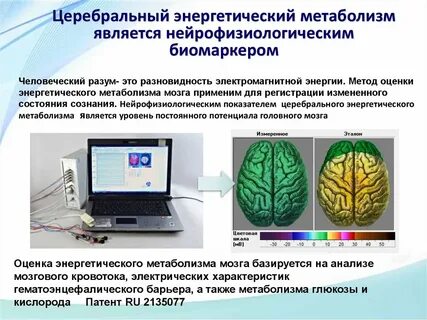 Лабораторная работа изучение головного мозга человека