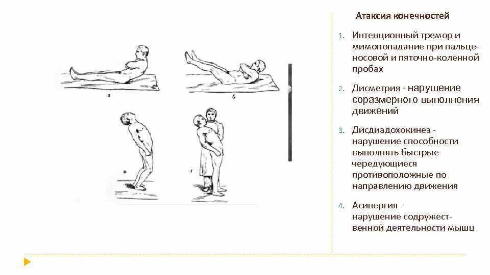 Что такое тремор конечностей. Что такое тремор конечностей