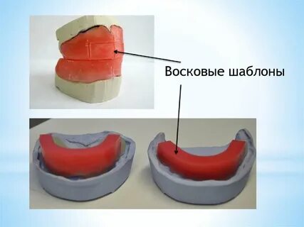 Прикусные валики