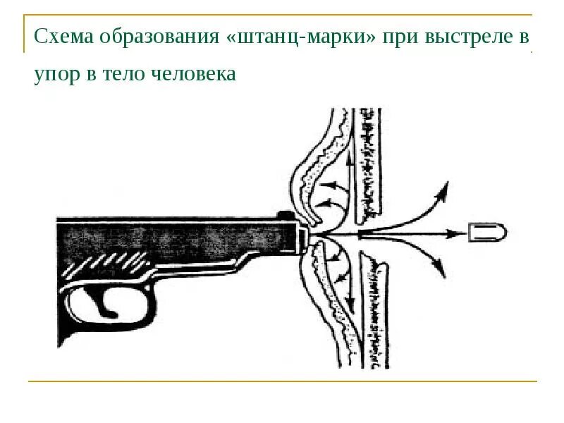 Выстрелить в упор. Огнестрельные повреждения при выстреле в упор. огнестрельное ранение.выстрел в упор. судебная медицина. огнестрельное ранение штанц марки. огнестрельная травма судебная медицина.