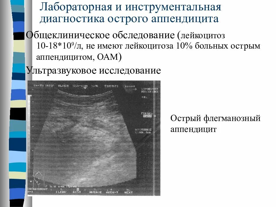 Аппендицит исследования. УЗИ при остром аппендиците заключение. Обследование при остром аппендиците. Инструментальная диагностика острого аппендицита. Методы обследования при остром аппендиците.