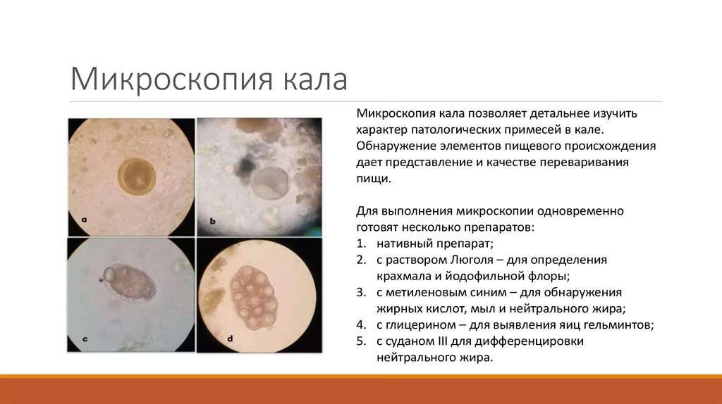 Микроскопия кала с Суданом 3. Микроскопия нативного препарата кала. Атлас копрограмма микроскопия. Копрограмма микроскопия исследование. Грибы в копрограмме у взрослого