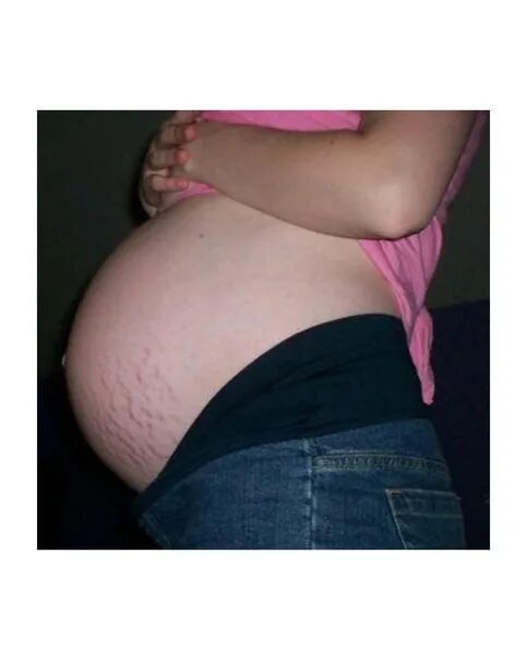 7 неделя беременности месячные. Живот на 6 месяце. Живот беременной. Живот беременной на 6 месяце. Небольшие животы беременных.