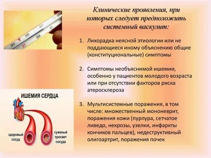 Васкулит какие анализы