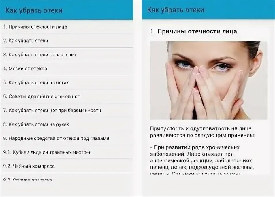 Как снять отек лица после запоя. Как избавиться от отеков.