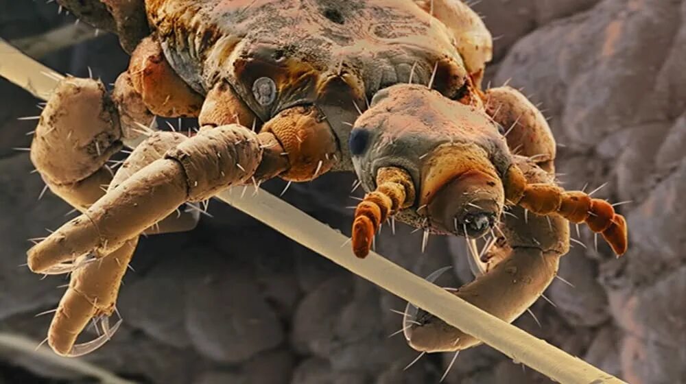 Feline Lice Treatment Factory Sale istgeodez.com