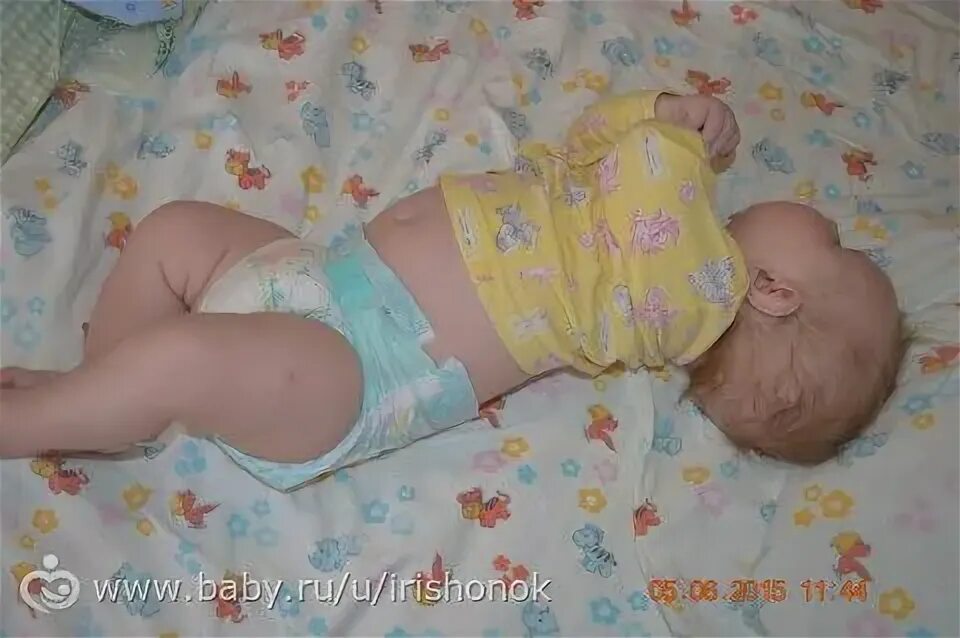 Грудничок выгибается дугой на животе. Ребенок запрокидывает голову назад. Ребенок 9 месяцев выгибается назад. Ребенок грудничок выгибает спину. Запрокидывание головы назад у грудничка.