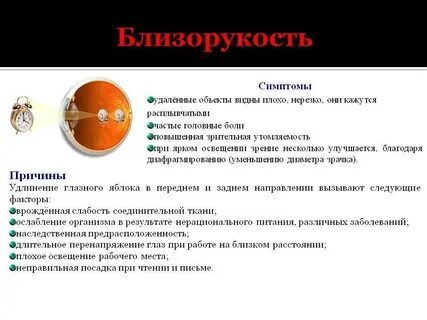 Признаки миопии
