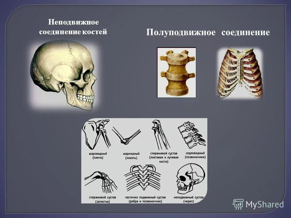 Неподвижные полуподвижные и подвижные соединения костей