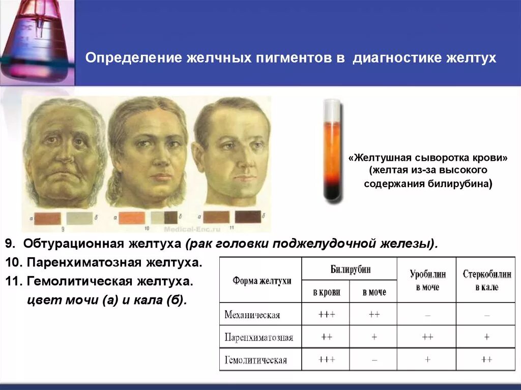 Сыворотка крови диагноз. Желточные пизменты в моче. Определение желчных пигментов. Желчные пигменты в моче. Обнаружение желчных пигментов в моче.