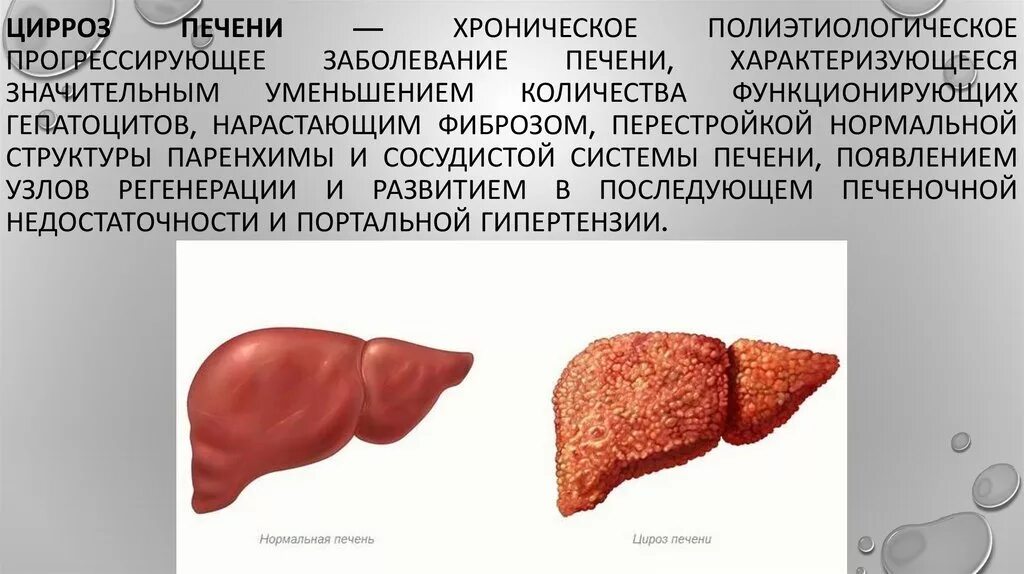Утиная печень в сметане - рецепты с фото на vpuzo.com