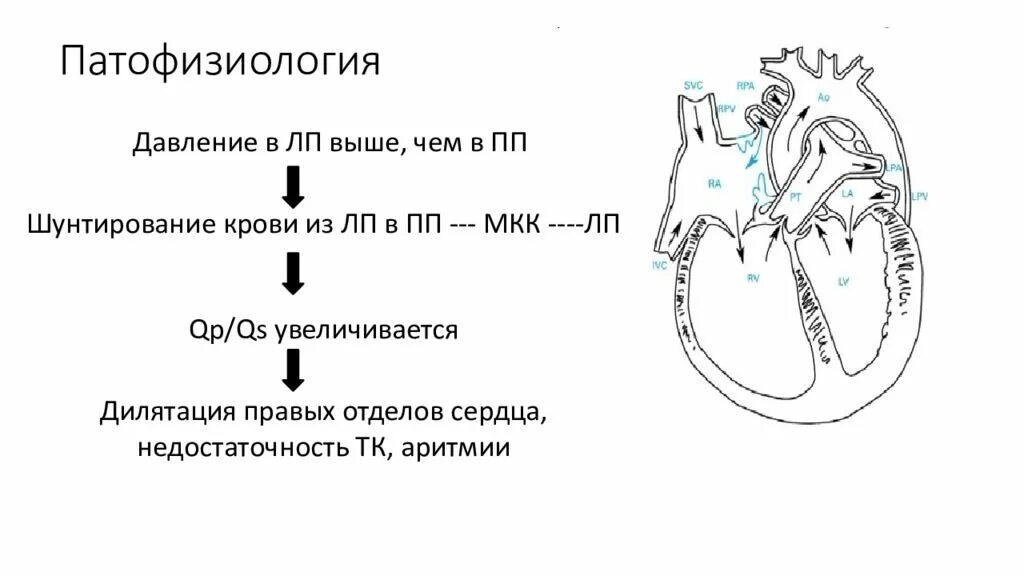 Дефект межпредсердной перегородки патофизиология. Дефект межпредсердной перегородки гемодинамика патогенез. Дефект межжелудочковой перегородки гемодинамика схема. ДМПП гемодинамика схема. Гемодинамика у детей