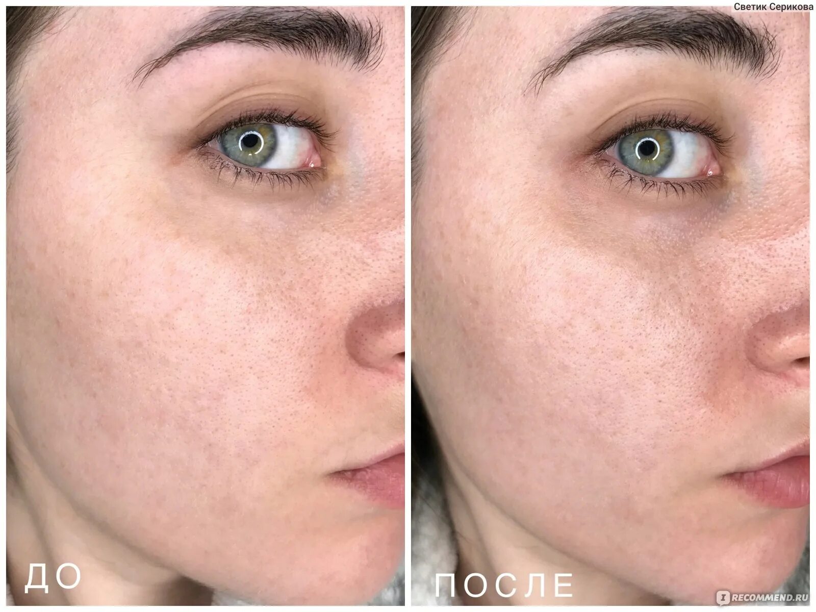 Лпд отзывы до и после сколько Маска для лица L'Oreal Paris Магия Глины Детокс и сияние: три натуральные глины