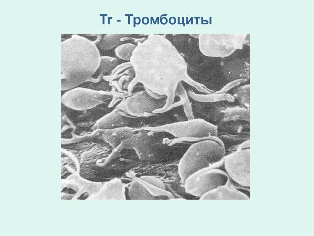 Тромбоциты 460. Форма и строение тромбоцитов. Если у ребенка повышены тромбоциты. Тромбоциты в мкл норма. Если у ребенка повышены тромбоциты.
