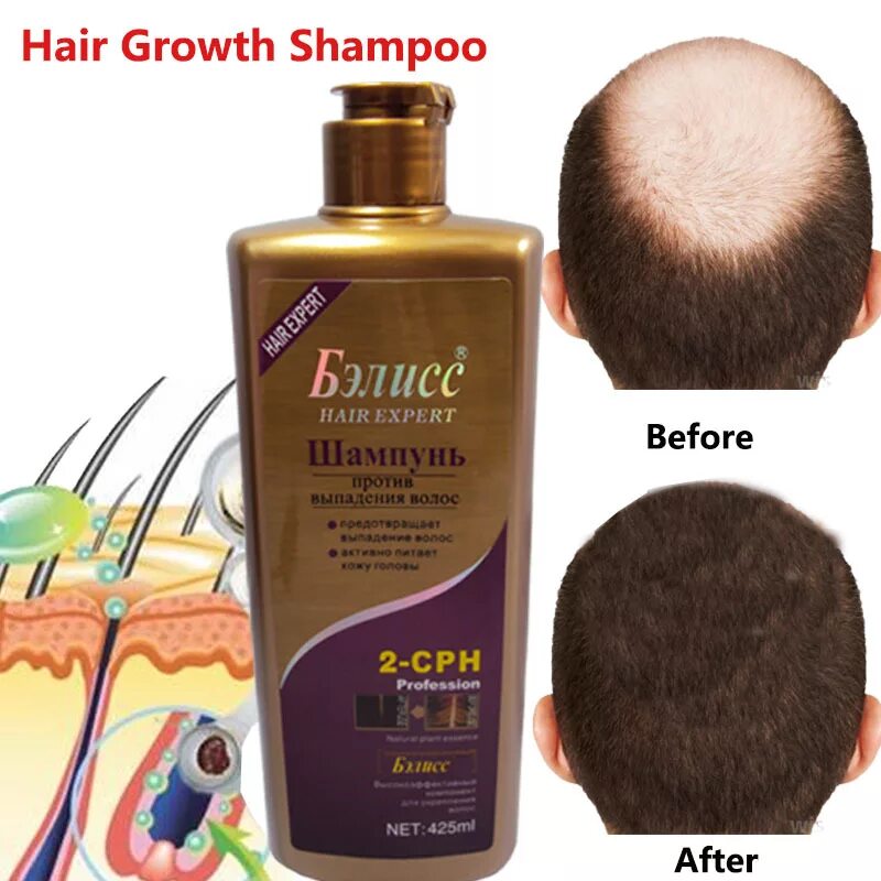 Какой самый лучший шампунь для волос. Vital hair maxima палитра. шампунь для роста волос. для выпадания волосы шампунем. шампунь для роста волос женский.
