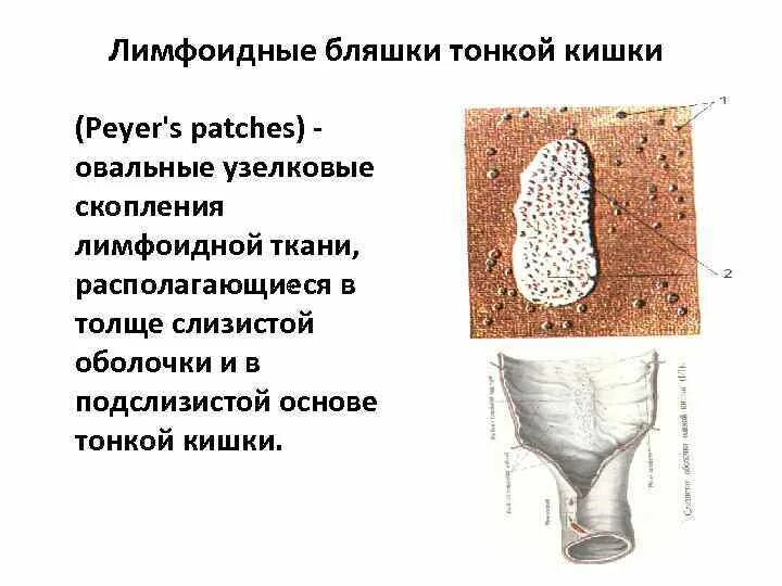 Ткани тонкой кишки. Лимфоидные бляшки тонкой кишки. Лимфоидные скопления в кишечнике. Лимфатические фолликулы тонкой кишки. Лимфоидные образования тонкой кишки.