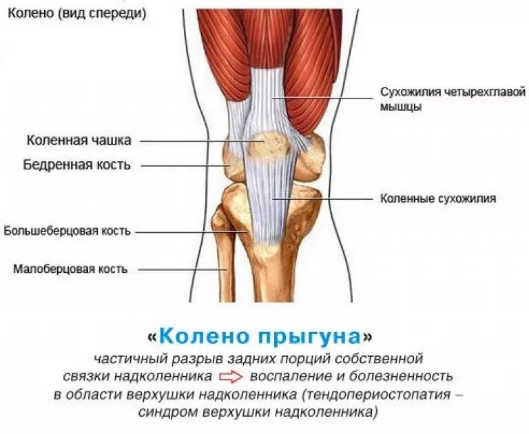 Лечение сухожилий суставов