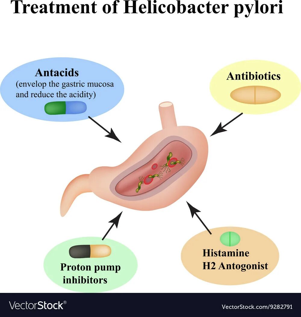 Мед хеликобактер. Обсеменение хеликобактер пилори. Хеликобактер пилори плакат. Степень обсеменения Helicobacter pylori. Сироп от хеликобактер пилори.