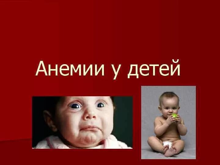 Анемия у детей раннего возраста. Железодефицитная анемия у детей. Жда у детей. Клиника анемии у детей.