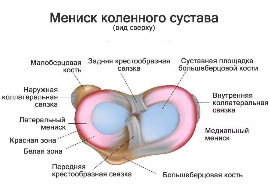 Строение мениска коленного сустава анатомия. Латеральный мениск коленного сустава функции. Латеральный и медиальный мениск коленного сустава. Внутренний мениск коленного сустава анатомия. Повреждение переднего рога