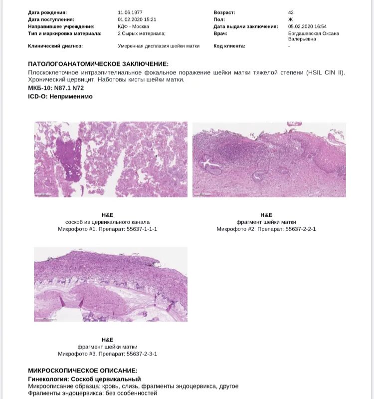 Конизация гистология. Наботовы кисты гистология. Шейка матки наботовы кисты гистология. Киста шейки матки микропрепарат. Наботова киста шейки матки гистология.