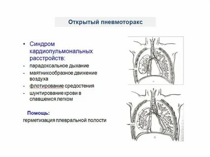 Физиология легких