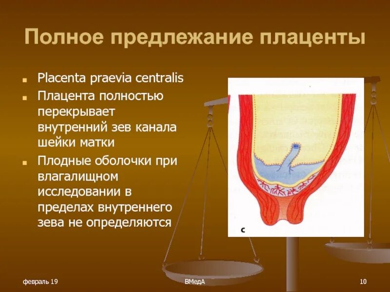 Зеве канал