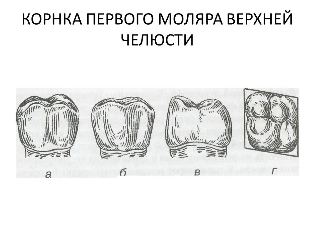 Первый моляр верхней челюсти