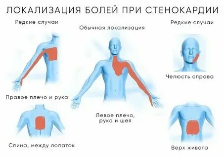 Болит рука отдает в грудную клетку