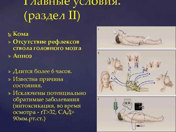 Отсутствие рефлексов. Рефлексы ствола головного мозга. Угнетение рефлексов ствола головного мозга.