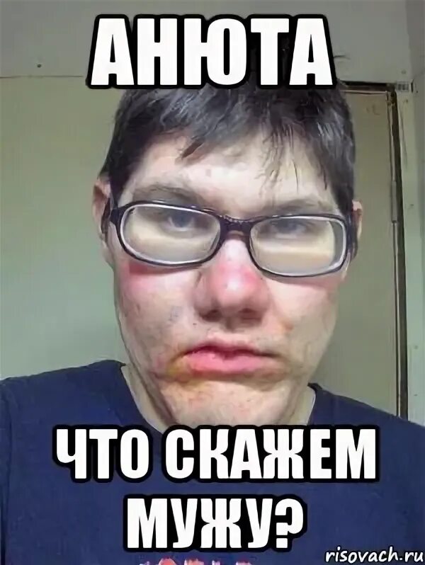 Почему анюты