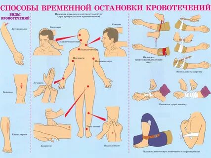 Препараты при артериальном кровотечении