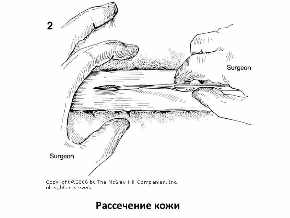 Рассечение термин. Рессечкние коде. рассечение желудка на латыни.