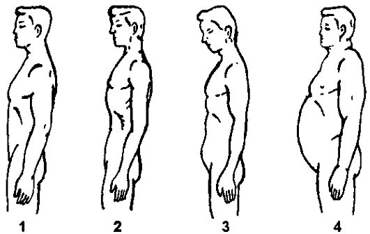 Формы живота у мужчин. Форма живота. Степени ожирения у мужчин. Форма живота виды. Формы живота у мужчин.