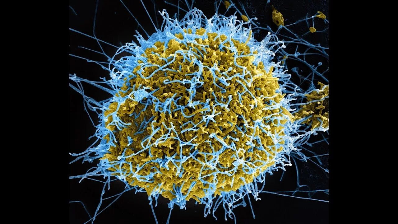 Virus making. Вирусы под микроскопом. Красивые вирусы под микроскопом. СПИД под микроскопом. Возбудитель гриппа под микроскопом.