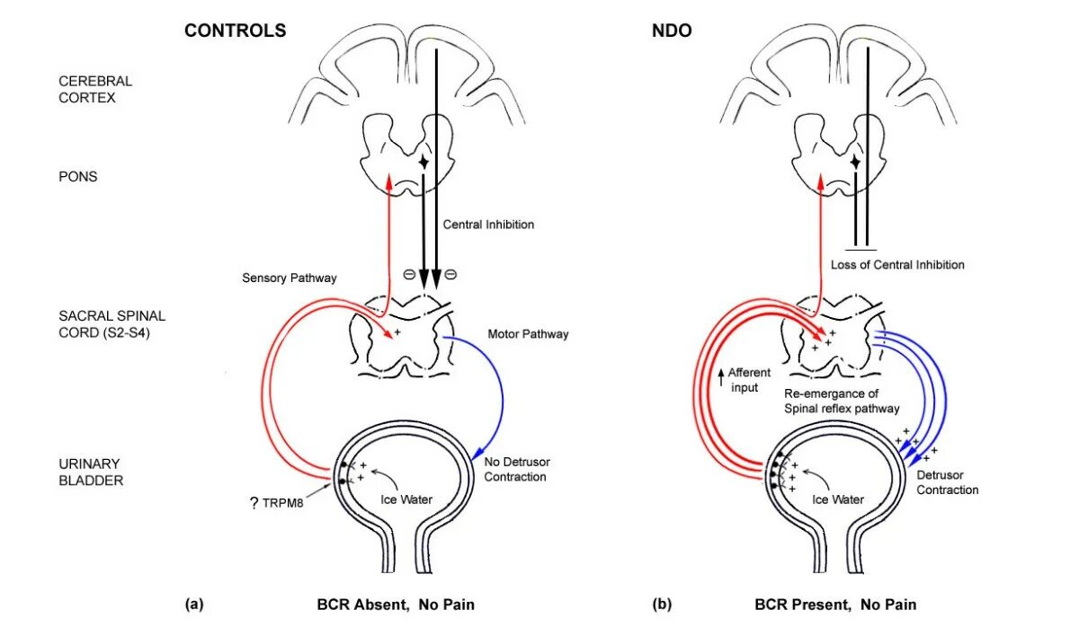 Оценка бульбокавернозного рефлекса. ВСД И мочевой пузырь. BCR рецепторы иммунология. Neurogenic bladder. Детрузор мочевого пузыря это