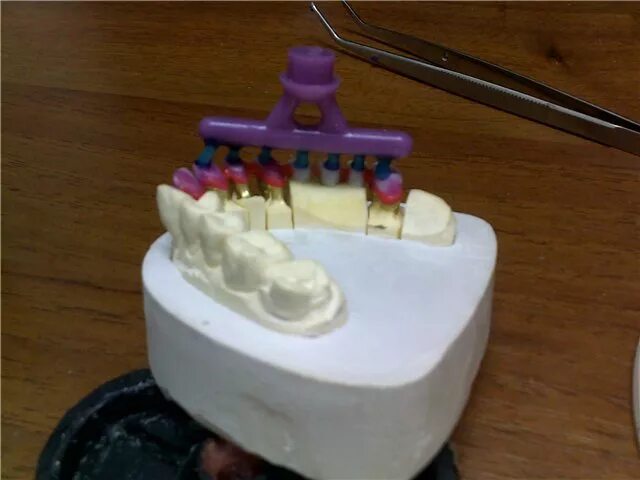 Литье зубной техник. Зуботехнический металл для литья ib21019. Зуботехническое литье. Зуботехническое литье. Зуботехническое литье.