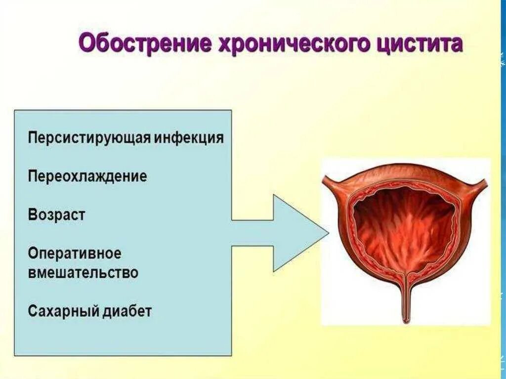 Цистит интерстициальный симптомы у женщин и лечение. Хронический цистит обострение. Острый и хронический цистит. Формы хронического цистита.