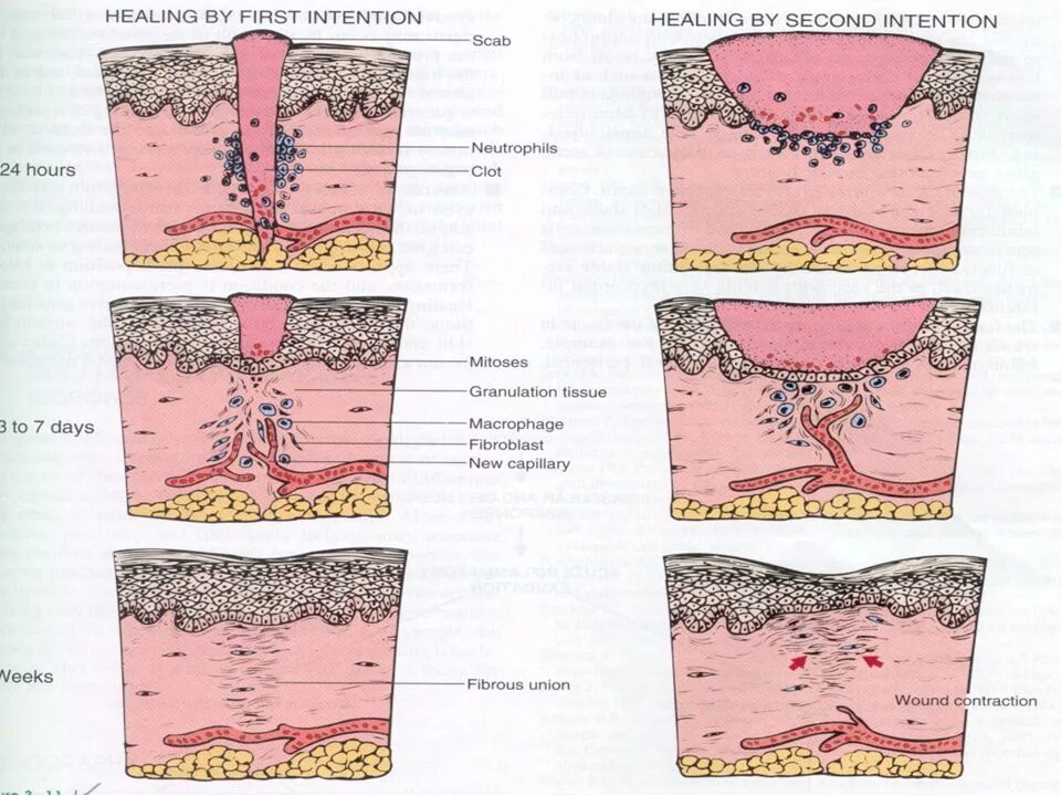 What is a wound. What is a wound