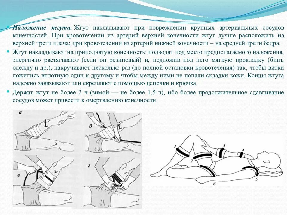 Наложение артериального жгута на нижнюю конечность. Техника наложения артериального жгута при артериальном кровотечении. Техника наложения жгута при повреждении артерии. Техника наложения жгута при ранении голени.. Техника наложения артериального резинового жгута (жгута Эсмарха):.
