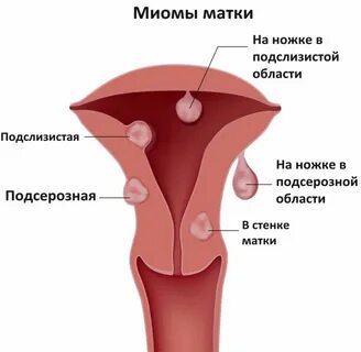 Почему матка приходит